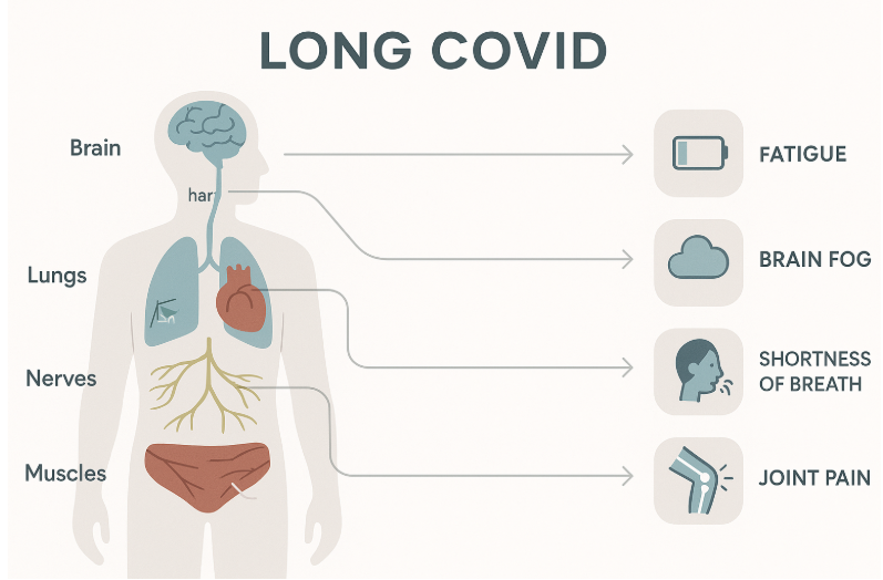 Infographic illustrating the effects of Long COVID on the brain, lungs, nerves, and muscles, with arrows pointing to symptoms like fatigue, brain fog, shortness of breath, and joint pain.